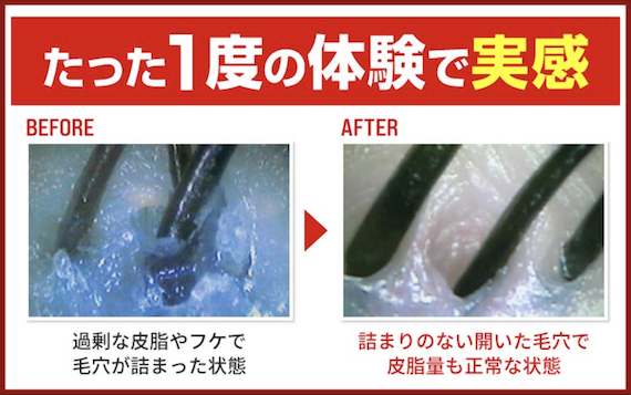 自信が持てない毎日にサヨナラ、髪と向き合う新しい日々
